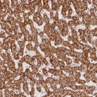 Immunohistochemical staining of human liver shows strong granular cytoplasmic positivity in hepatocytes.