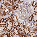 Immunohistochemical staining of human kidney shows strong granular cytoplasmic positivity in cells in tubules.