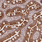 Immunohistochemical staining of human small intestine shows strong cytoplasmic positivity in glandular cells.