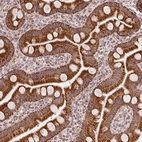 Immunohistochemical staining of human small intestine shows strong cytoplasmic positivity in glandular cells.