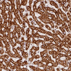 Anti-SDHB Antibody