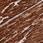 Immunohistochemical staining of human heart muscle shows strong cytoplasmic positivity in cardiomyocytes.