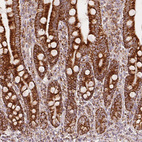 Immunohistochemical staining of human duodenum shows strong positivity in glandular cells.