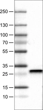 Lane 1: Marker [kDa]_br/_Lane 2: Human cell line RT-4