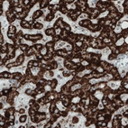 Immunohistochemical staining of human liver shows strong granular cytoplasmic immunoreactivity in hepatocytes.