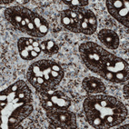 Anti-SDHB Antibody