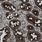 Immunohistochemical staining of human duodenum shows strong granular cytoplasmic immunoreactivity in glandular cells.