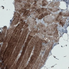 Immunohistochemical staining of human skeltal muscle shows granular cytoplasmic positivity in muscle fibers.