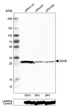 Western blot analysis in RT-4 cells transfected with control siRNA, target specific siRNA probe #1 and #2, using Anti-SDHB antibody. Remaining relative intensity is presented. Loading control: Anti-PPIB.