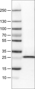 Lane 1: Marker [kDa]_br/_Lane 2: Human cell line RT-4