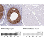 Anti-P4HA2 Antibody