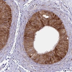 Immunohistochemical staining of human epididymis shows moderate to strong cytoplasmic positivity in glandular cells.