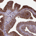 Immunohistochemical staining of human fallopian tube shows moderate to strong cytoplasmic positivity in glandular cells.