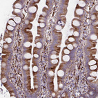 Anti-P4HA2 Antibody