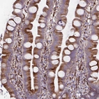 Immunohistochemical staining of human small intestine shows moderate cytoplasmic positivity in glandular cells.