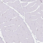 Anti-P4HA2 Antibody