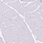 Immunohistochemical staining of human skeletal muscle shows no positivity in striated muscle fibers as expected.