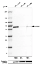 Western blot analysis in U-251MG cells transfected with control siRNA, target specific siRNA probe #1 and #2, using Anti-P4HA2 antibody. Remaining relative intensity is presented. Loading control: Anti-GAPDH.