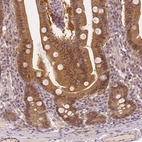 Immunohistochemical staining of human duodenum shows strong cytoplasmic positivity in glandular cells.