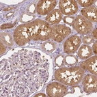 Immunohistochemical staining of human kidney shows strong cytoplasmic positivity in cells in tubules.