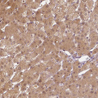 Immunohistochemical staining of human liver shows moderate cytoplasmic positivity in hepatocytes.