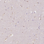Immunohistochemical staining of human cerebral cortex shows no positivity in neurons as expected.