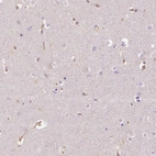 Immunohistochemical staining of human cerebral cortex shows no positivity in neurons as expected.
