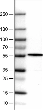 Lane 1: Marker [kDa]_br/_Lane 2: Human liver tissue lysate