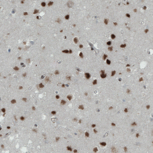 Anti-MEF2C Antibody