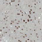 Anti-MEF2C Antibody