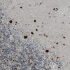 Anti-MEF2C Antibody