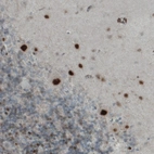 Immunohistochemical staining of human cerebellum shows strong nuclear positivity in Purkinje cells.