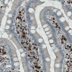 Immunohistochemical staining of human duodenum shows strong nuclear immunoreactivity in a subset of lymphoid cells.