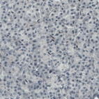 Anti-MEF2C Antibody