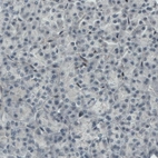 Immunohistochemical staining of human pancreas shows absense of staining (negative control).