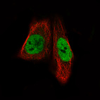 Anti-MEF2C Antibody