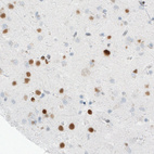 Anti-MEF2C Antibody