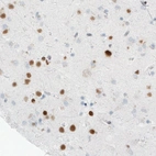 Anti-MEF2C Antibody