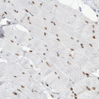 Immunohistochemical staining of human skeletal muscle shows distinct nuclear positivity in the muscle fibres.