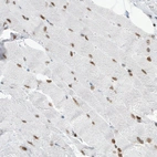 Immunohistochemical staining of human skeletal muscle shows distinct nuclear positivity in the muscle fibres.