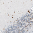 Anti-MEF2C Antibody