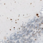 Immunohistochemical staining of human cerebellum shows nuclear immunoreactivity in Purkinje cells, as well as in neuronal cells in the granular and molecular layers.