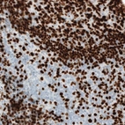 Immunohistochemical staining of human tonsil shows strong nuclear immunoreactivity in the germinal center cells.