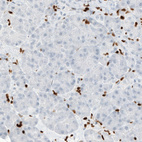 Anti-MEF2C Antibody