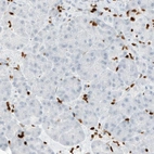 Immunohistochemical staining of human pancreas shows absence of staining in the exocrine glandular cells (negative control).