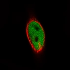 Immunofluorescence staining of RH-30 cells using the Anti-MEF2C monoclonal antibody, showing specific staining in the nucleoplasm in green. Microtubule- and nuclear probes are visualized in red and blue, respectively (where available).