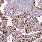 Immunohistochemical staining of human placenta shows strong nuclear and some cytoplasmic positivity in endothelial cells.