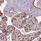 Immunohistochemical staining of human placenta shows strong nuclear and some cytoplasmic positivity in endothelial cells.
