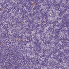 Immunohistochemical staining of human lymph node shows no nuclear positivity in lymphoid cells as expected.