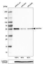 Western blot analysis in EFO-21 cells transfected with control siRNA, target specific siRNA probe #1 and #2, using Anti-WWTR1 antibody. Remaining relative intensity is presented. Loading control: Anti-PPIB.